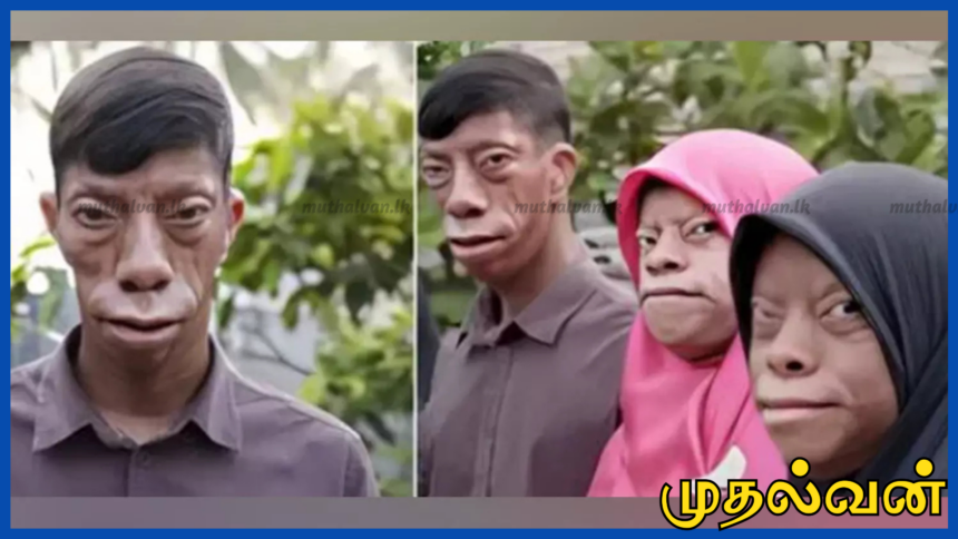 இந்தோனேசியாவில் ஒரே நபருக்கு பகலில் மனிதன், இரவில் பல்லி போல முகமாற்றம்